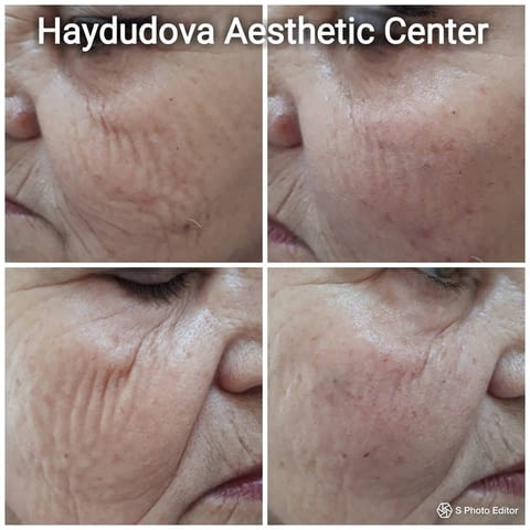 Haydudova Aesthetic Center - град Плевен | Медицински клиники и кабинети - снимка 4