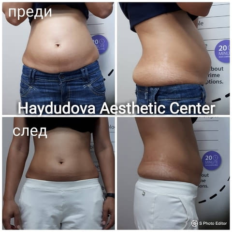Haydudova Aesthetic Center - град Плевен | Медицински клиники и кабинети - снимка 5