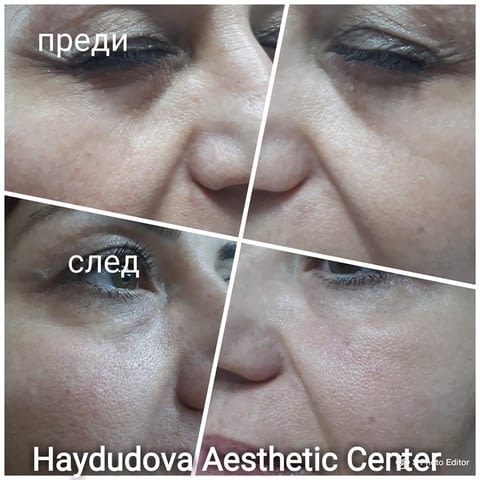Haydudova Aesthetic Center - град Плевен | Медицински клиники и кабинети - снимка 6