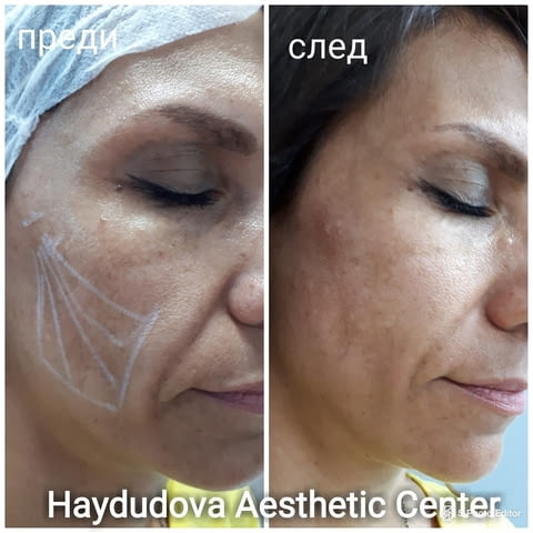 Haydudova Aesthetic Center - град Плевен | Медицински клиники и кабинети - снимка 7