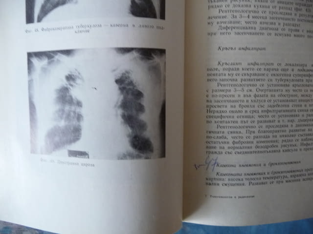 Рентгенология и радиология рентген диагностика кости вътрешни органи - снимка 3