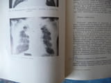 Рентгенология и радиология рентген диагностика кости вътрешни органи