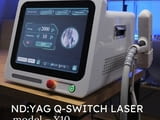 Лазерно премахване на перманентен грим с ND YAG Q-Switch лазер.