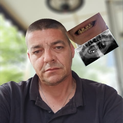  Моля за помощ – спешна дарителска кампания за лечение , city of Sofia | Treatments & Procedures - снимка 1