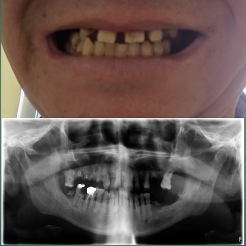  Моля за помощ – спешна дарителска кампания за лечение , city of Sofia | Treatments & Procedures - снимка 3