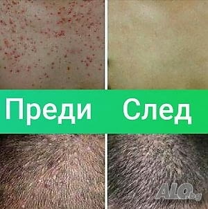 Крем Yiganerjing за псориазис, екземи, град София | Традиционна / Народна Медицина - снимка 2