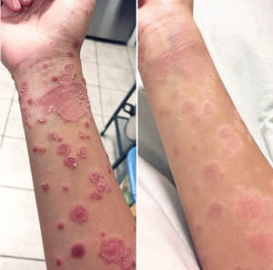 Крем Yiganerjing за псориазис, екземи, град София | Традиционна / Народна Медицина - снимка 5