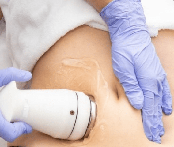 Антицелулитни процедури и масажи (-40%) - city of Sofia | Weight Loss - снимка 6